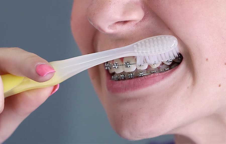 Đánh răng ít nhất 2-3 lần một ngày sau bữa ăn chính