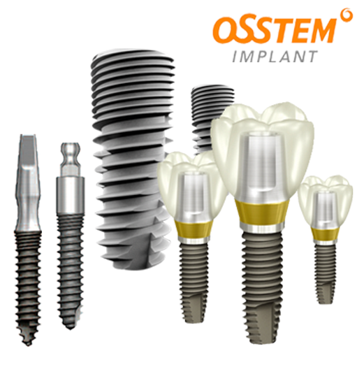 OSSTEM Implant: 3 considerable benefits of Implant Osstem