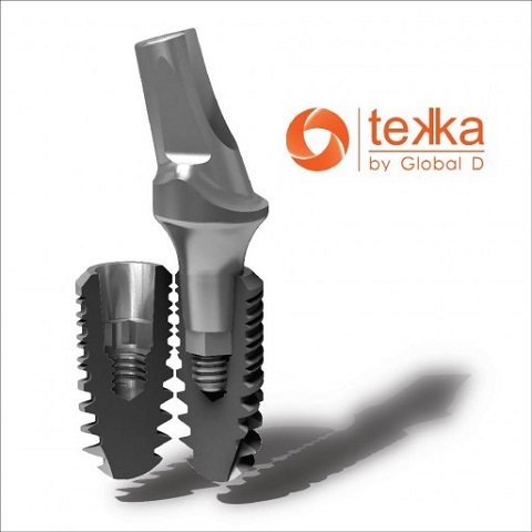 Tekka implant 3 significant advantages of tekka implant
