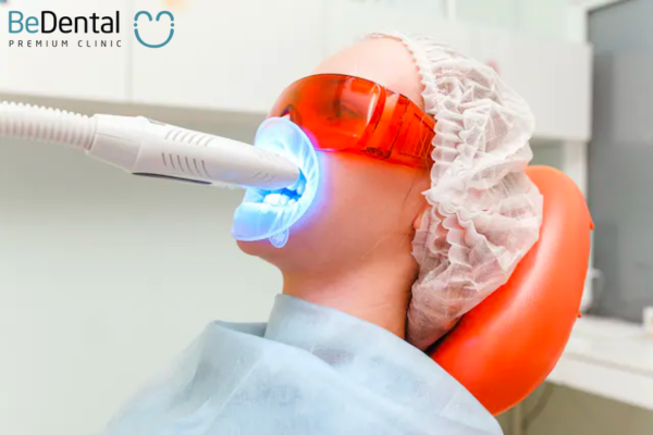 Giá tẩy trắng răng ở mỗi phương pháp có sự khác biệt đáng kể