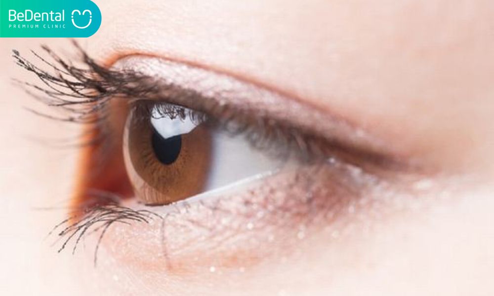 Mắt bồ câu là gì? 1 số giải pháp khiến mắt bồ câu trở nên đẹp hơn