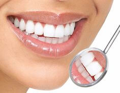 Bọc răng sứ cho răng sâu bao nhiêu tiền và quy trình bọc răng sứ cho răng sâu!. 